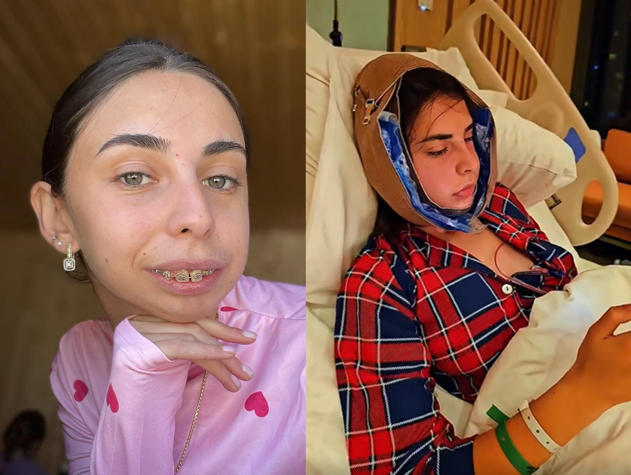 ლილიანას რეაქცია, როდესაც მისი ახალი სახე პირველად ნახა – ვიდეო