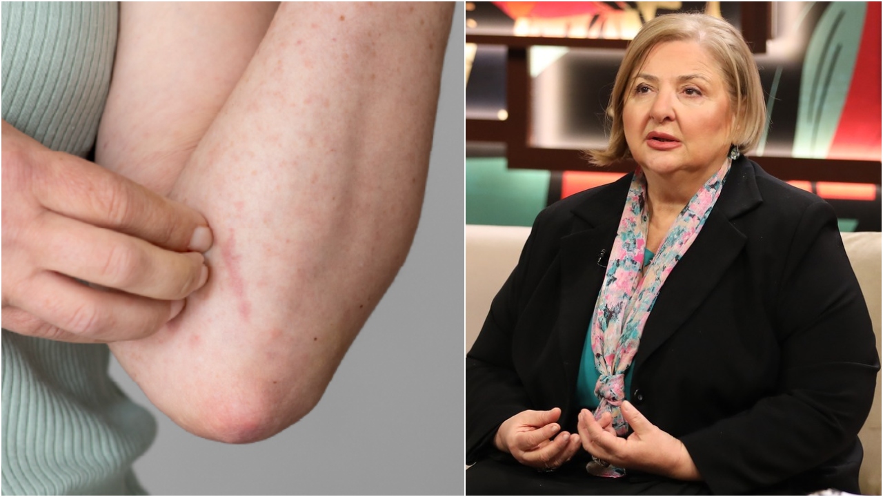 უნდა გადავყაროთ თუ არა მუნით დაინფიცირებული სამოსი ? – რას ამბობს დერმატო-ვენეროლოგი თინა ქიტუაშვილი