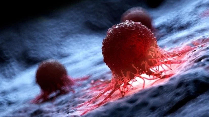 სიმსივნის შესაძლო ნიშნები, რომლებიც დილით ვლინდება