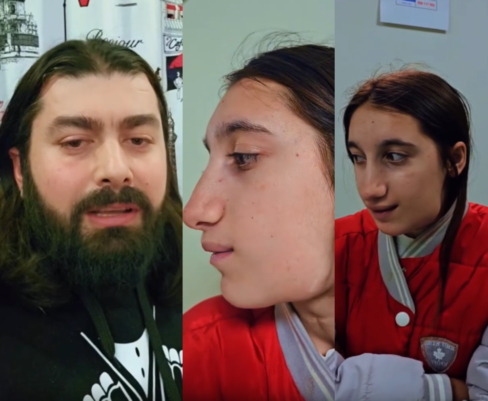 “მარიამის მდგომარეობა უამრავ ადამიანს აინტერესებდა, თამაშის დროს სახეში მოხვდა ხელი და…”- რა ვიდეოს აქვეყნებს ფოტოგრაფი დანტესი მარიამ კოხრეიძის შესახებ ?